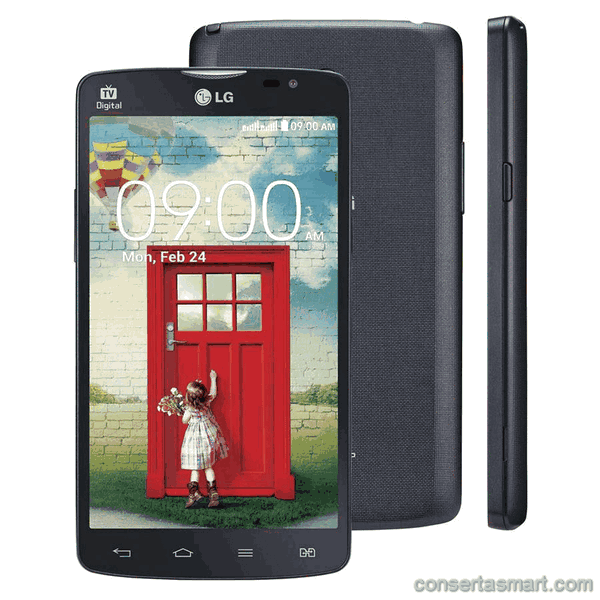 molhou LG L80 Dual TV